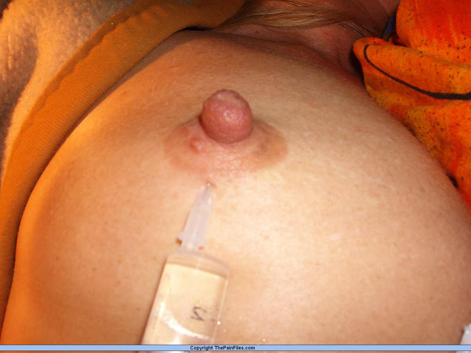 Saline boob injection